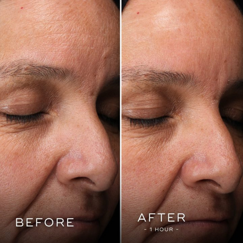 Medik8, H.E.O. Mask, dwuetapowa maska na noc, 2x50 ml